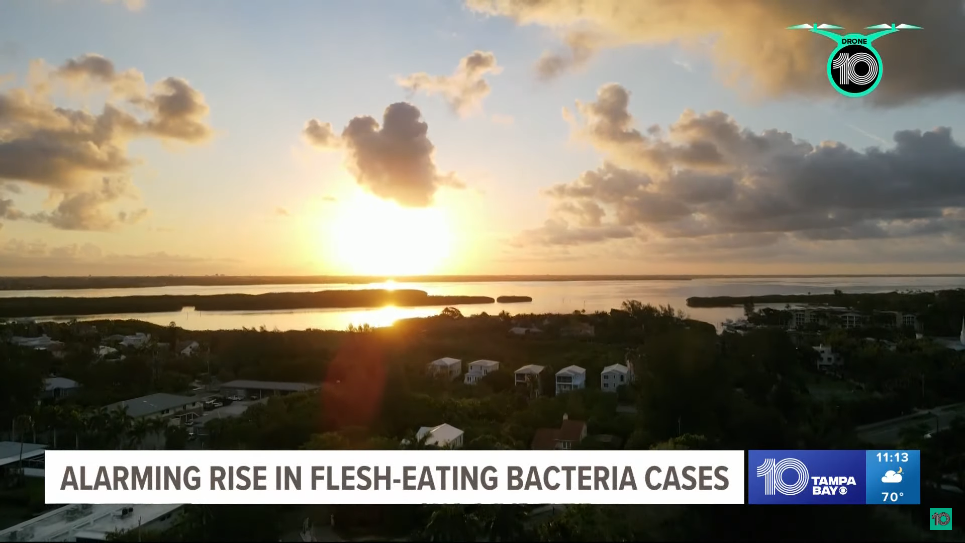 Flesh-eating Bacteria Cases At A 15-year High In Florida - The Suncoast ...